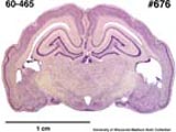 Nine-banded armadillo brain (sectioned)